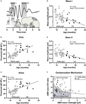 Stress Affects Central Compensation of Neural Responses to Cochlear Synaptopathy in a cGMP-Dependent Way